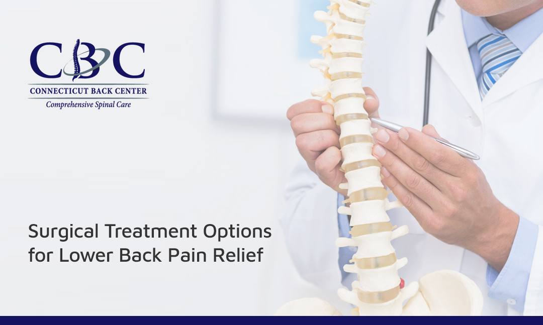 Surgical Treatment Options for Lower Back Pain Relief